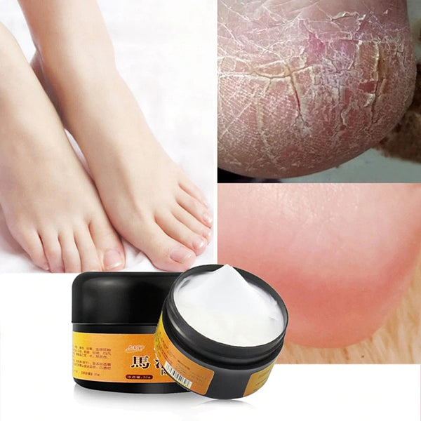 30g Natural Horse Oil Hand Foot Peeling Repair Cream Feet Massage for Athlete's Feet Itch Blisters Anti-chapping Foot Care TSLM2
