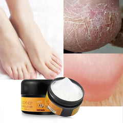 30g Natural Horse Oil Hand Foot Peeling Repair Cream Feet Massage for Athlete's Feet Itch Blisters Anti-chapping Foot Care TSLM2