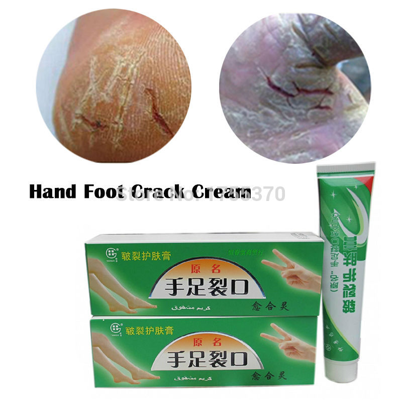 Hand Foot Crack Cream Heel Chapped Peeling Repair Anti Dry Crack Winter Feet Care Chinese Medicinal Ointment Cream