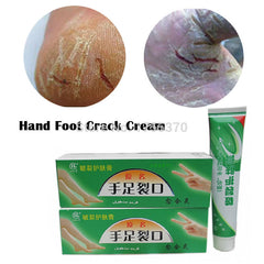 Hand Foot Crack Cream Heel Chapped Peeling Repair Anti Dry Crack Winter Feet Care Chinese Medicinal Ointment Cream
